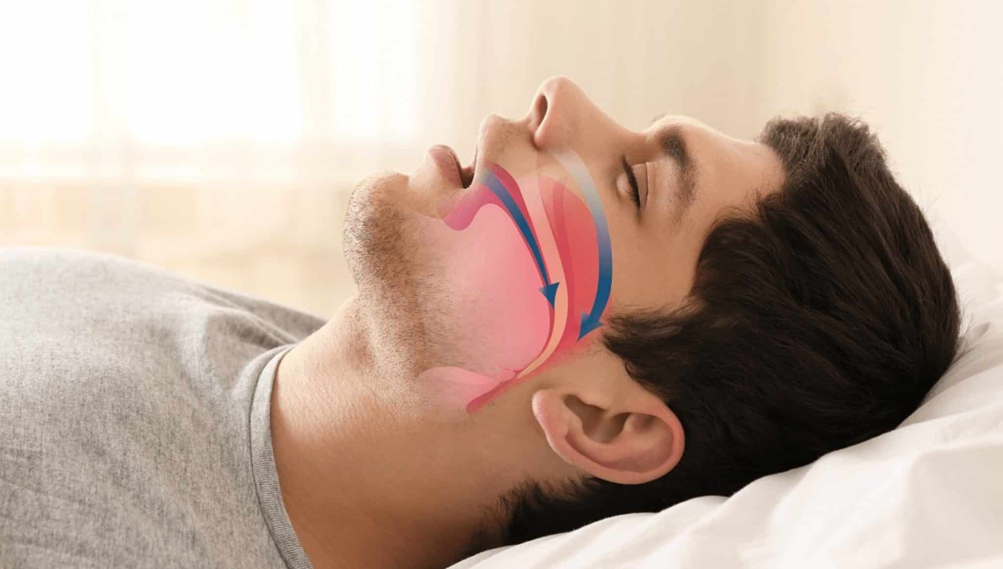 5 Best Sleep Apnea Pillows Of 2023 Useful For Your Sleeping Positions